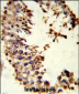 ACR Antibody (Center)