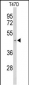 ACR Antibody (Center)