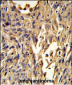 S100A10 Antibody (Center)