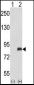 ADRBK2 Antibody (N-term)