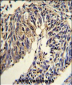 TNFRSF14 Antibody (Center)