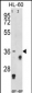 TNFRSF14 Antibody (Center)