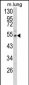 EFEMP1 Antibody (N-term)