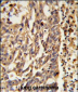 KIF11 Antibody (N-term)