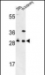 GCLM Antibody (C-term)