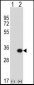 GCLM Antibody (C-term)