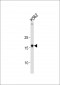 HMGA1 Antibody (C-term)