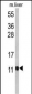 PCBD1 Antibody (Center)