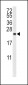 IL10 Antibody (Center)