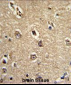 BECN1 Antibody (Ascites)