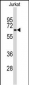 BECN1 Antibody (Ascites)