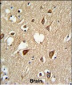 SUMO1 Antibody