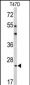 BCL2A1 Antibody (Center)