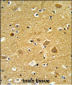 TNPO1 Antibody (N-term)
