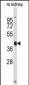 RFC3 Antibody (C-term)