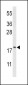 CFL1 Antibody (Center)