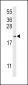 CFL1 Antibody (Center)