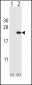 CFL1 Antibody (Center)