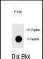 Phospho-TAL1(T90) Antibody