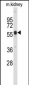 Park6(PINK1) Antibody(C-term)