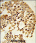 DPP8 Antibody (N-term)