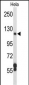 DPP8 Antibody (N-term)