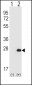 HPRT1 Antibody (N-term)