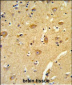 TOMM70A Antibody (N-term)