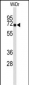 TOMM70A Antibody (N-term)