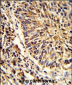 ADAM9 Antibody (C-term)