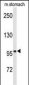 EphB3 Antibody