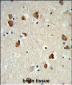 RPS6KB2 Antibody