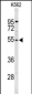 RPS6KB2 Antibody