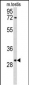 RPA2 Antibody (N-term) )