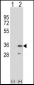 RPA2 Antibody (N-term) )