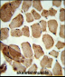 Denatured  ATG1 Antibody