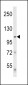 Denatured  ATG1 Antibody