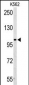 AMPD2 Antibody (Center)