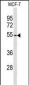 ADAMDEC1 Antibody (N-term)