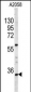 HOXA9 Antibody (C-term)