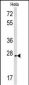 CREM Antibody (C-term)