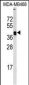 LOX Antibody (Center)