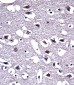 OPRM1 Antibody (Center)