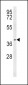 PTGER3 Antibody (N-term)