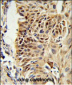 CIRBP Antibody (C-term)