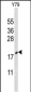 CIRBP Antibody (C-term)