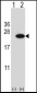 CIRBP Antibody (C-term)