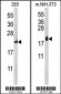 RPL18A Antibody (C-term)