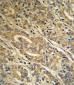 ACOT8 Antibody (C-term)