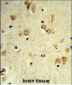 PEX14 Antibody (C-term)